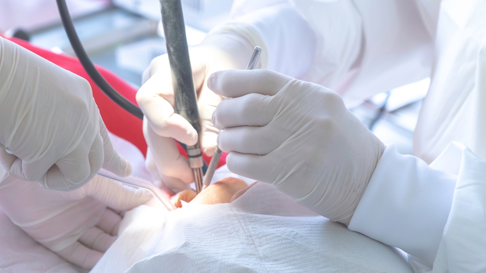 Surgery of Wisdom Teeth: What to Expect and How to Heal Confidently