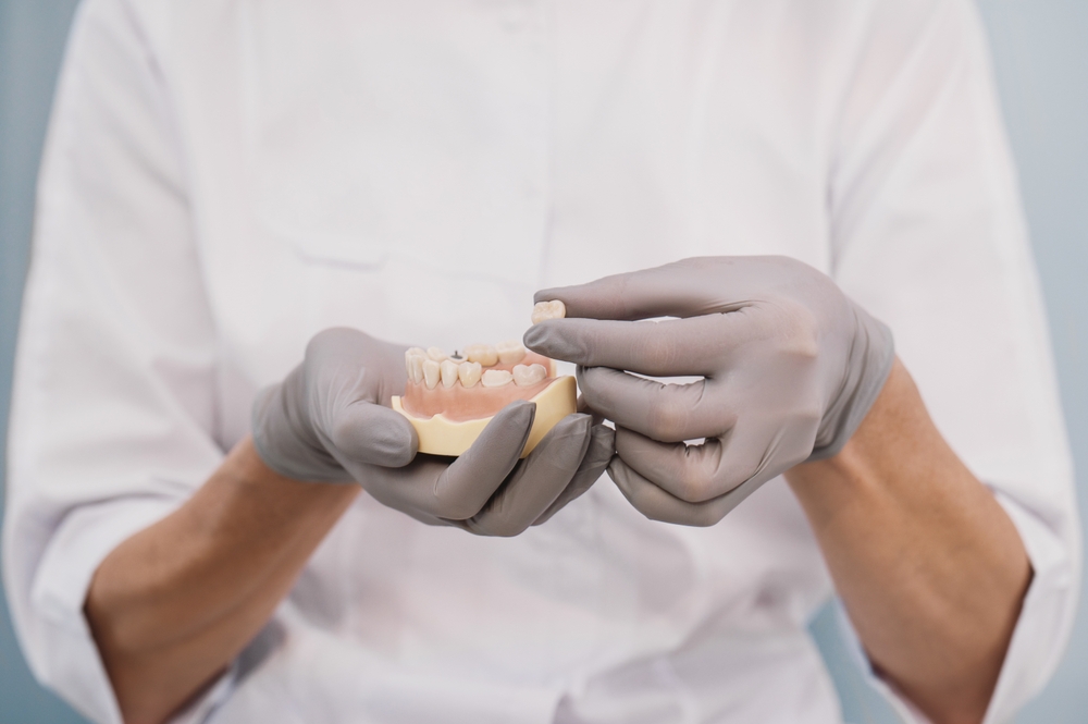 Restore Your Smile With "Affordable Dental Crowns Near Me"